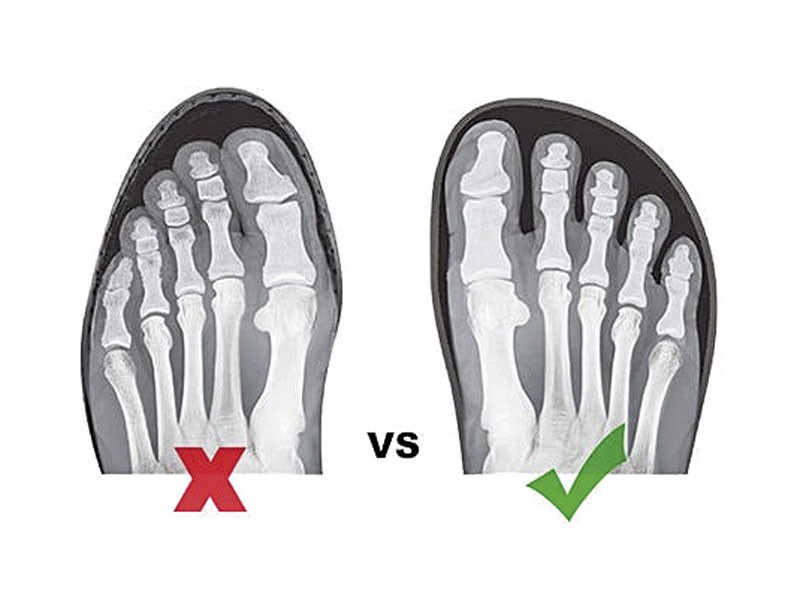 BAREFOOT: ¿Un cambio en la concepción del calzado?